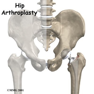 Osteopathy Massage and Acupuncture for hip pain | Osteopath in Hatfield